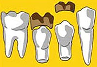 Regulärer Zahndurchbruch
