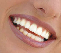 Schöne Zähne - strahlendes Lächeln