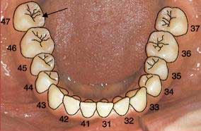 Zahnschema Unterkiefer
